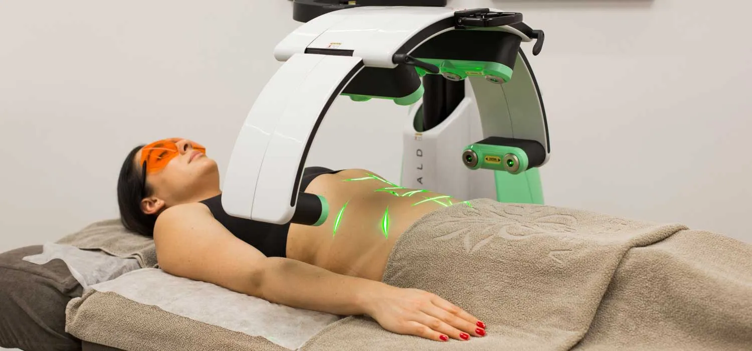 Emerald Laser treatment in progress on the abdomen