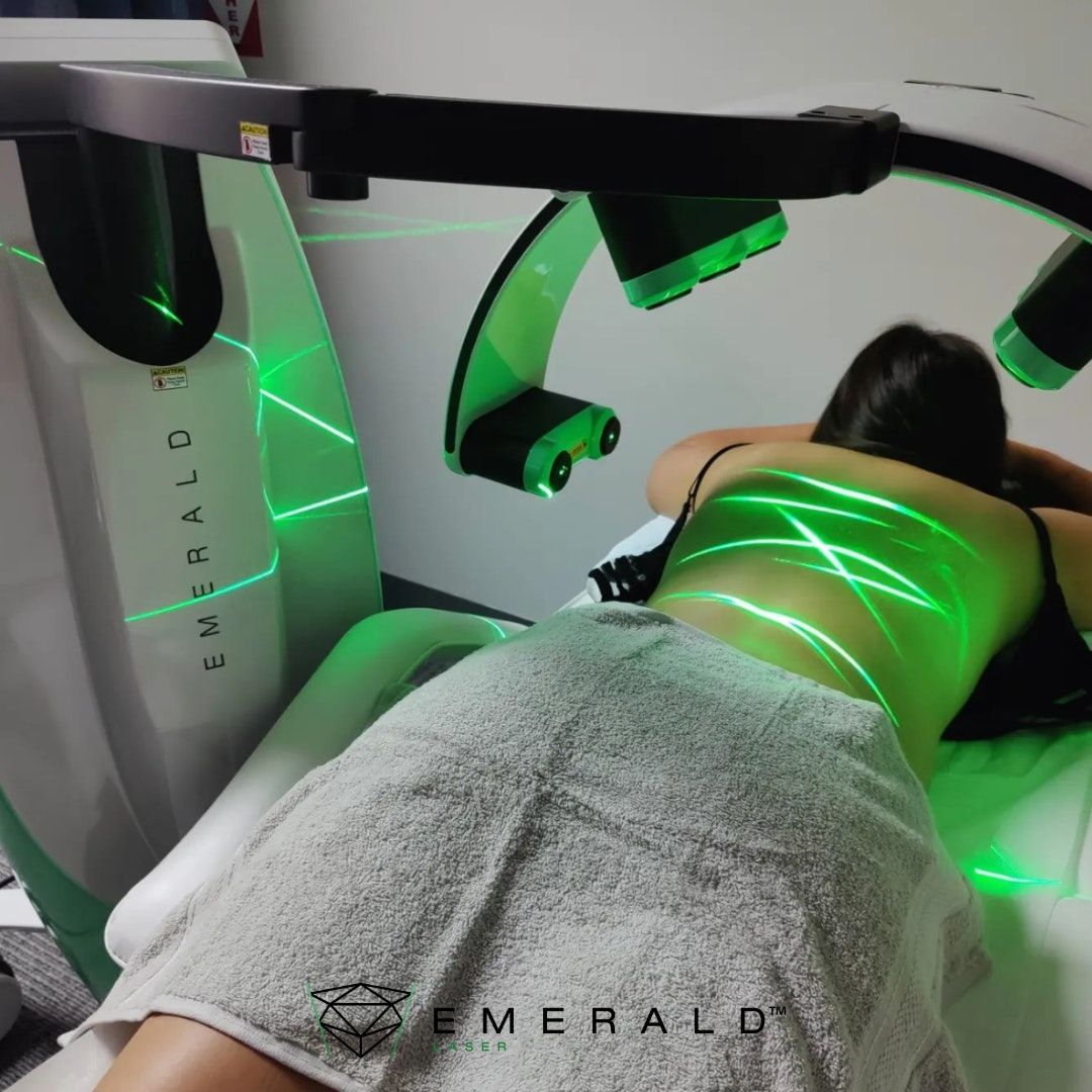 Patient having an Emerald Laser treatment