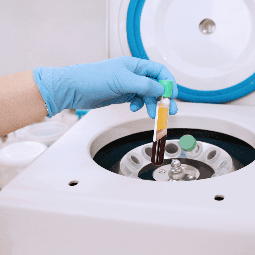 Blood sample being placed in a centrifuge for PRP