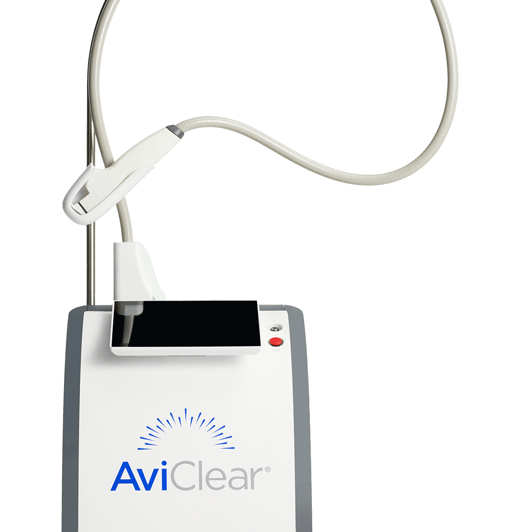 AviClear acne laser by Cutera at A Aesthetics